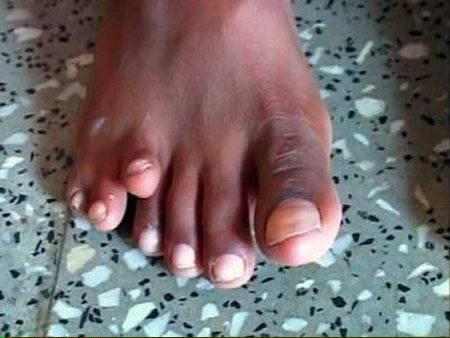 Seven Toe Foot