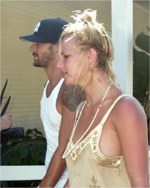 britney looking not so hot, with a hickey to top it off