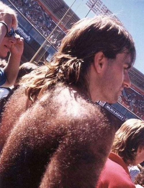 Get out the razor, we have a major case of back hair